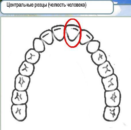 Лопатовидные резцы зубов как выглядят