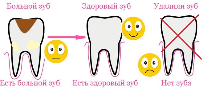 Стоит ли слушать врачей и удалять зубы мудрости, вместо лечения?
