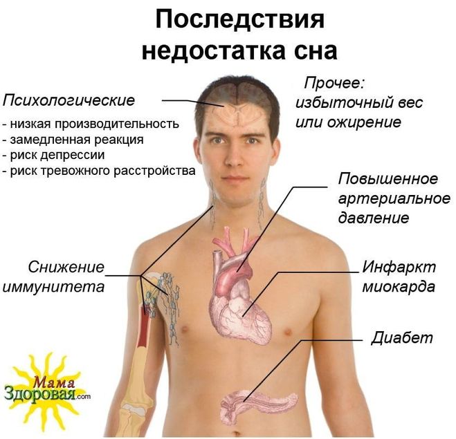 Какие могут быть последствия от этого. Нарушение сна осложнения. последствия недосыпания. недостаток сна последствия. влияние сна на организм человека.
