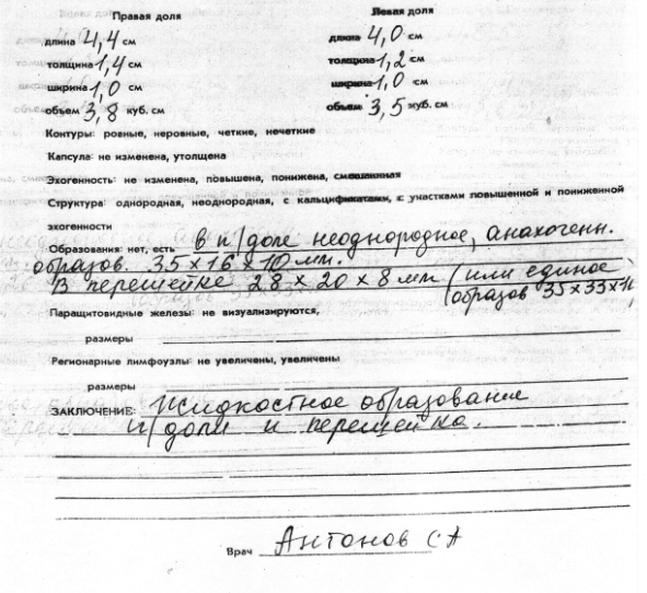 Многоузловой нетоксический зоб: причины, симптомы и лечение в ФНКЦ ФМБА